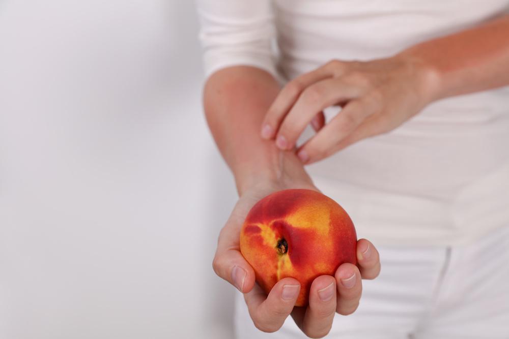 What To Do During An Allergic Reaction